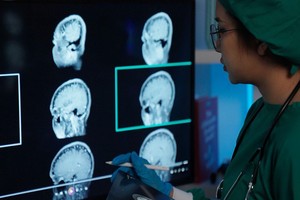 Can MRI See Blood Clots Understanding How Imaging Detects Vascular Problems - Presented by PostDICOM